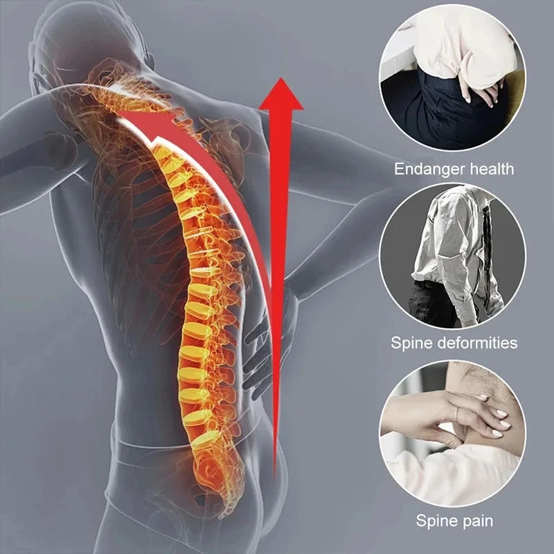 FODRKE Adjustable Back Brace Posture Corrector For Spine