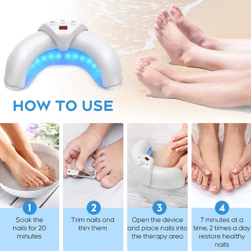 Hign Concerned Fungal Nail Laser Device For Toenail Fungus