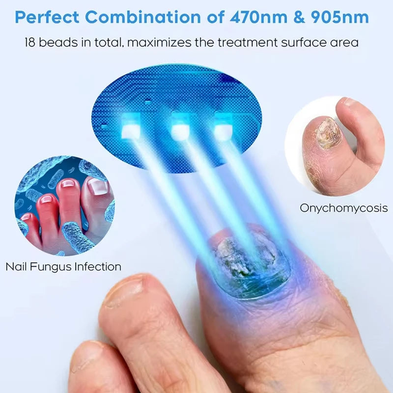 Hign Concerned Fungal Nail Laser Device For Toenail Fungus